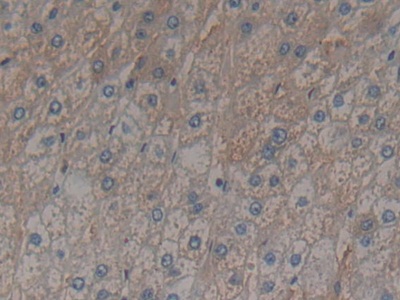 Polyclonal Antibody to 17-Beta-Hydroxysteroid Dehydrogenase Type 12 (HSD17b12)