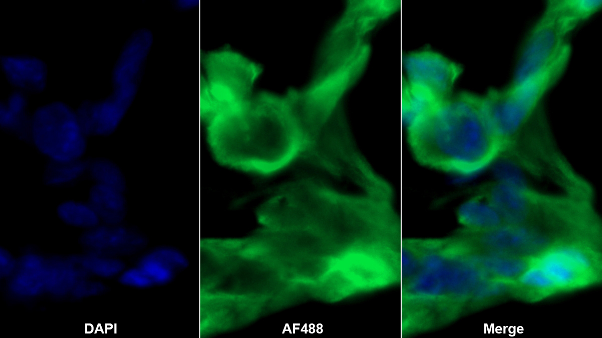 Polyclonal Antibody to 17-Beta-Hydroxysteroid Dehydrogenase Type 12 (HSD17b12)
