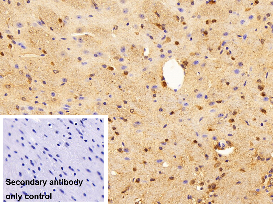 Polyclonal Antibody to Aminoacylase 2 (ACY2)