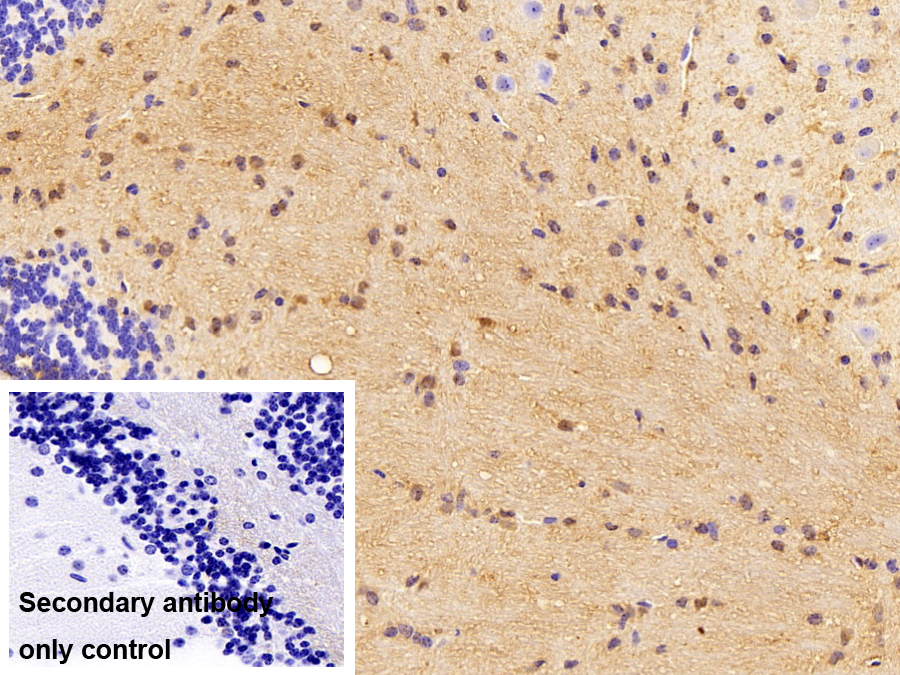 Polyclonal Antibody to Aminoacylase 2 (ACY2)