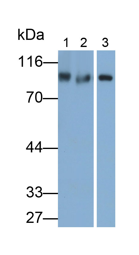 Polyclonal Antibody to Calpain 7 (CAPN7)