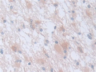 Polyclonal Antibody to Calpain, Small Subunit 1 (CAPNS1)