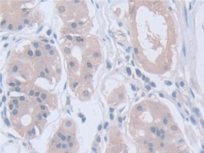 Polyclonal Antibody to Calpain, Small Subunit 1 (CAPNS1)