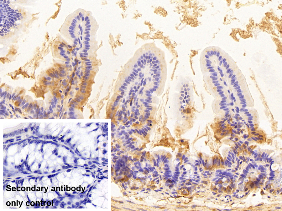Polyclonal Antibody to Calcyphosine 2 (CAPS2)