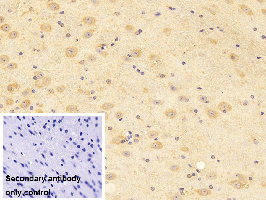 Polyclonal Antibody to Calcyphosine 2 (CAPS2)