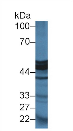 Polyclonal Antibody to Carboxypeptidase A1, Pancreatic (CPA1)