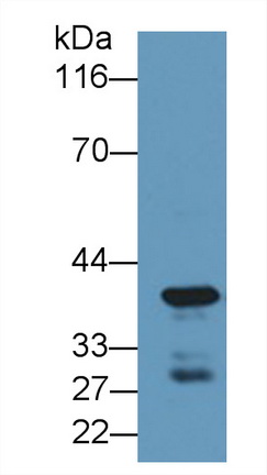 Polyclonal Antibody to Carboxypeptidase A4 (CPA4)