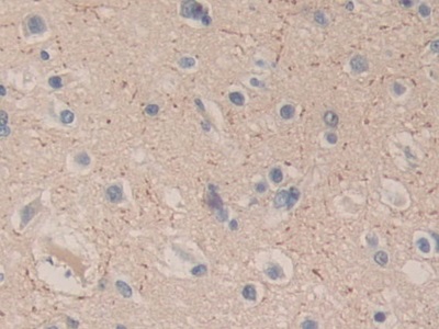 Polyclonal Antibody to Carboxypeptidase B1, Tissue (CPB1)