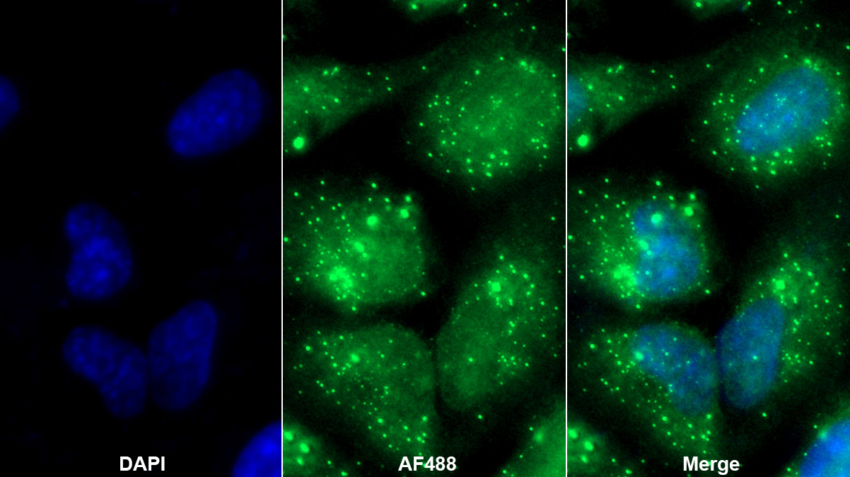 Polyclonal Antibody to Crystallin Beta B2 (CRYbB2)