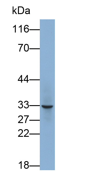 Polyclonal Antibody to Crystallin Lambda 1 (CRYl1)