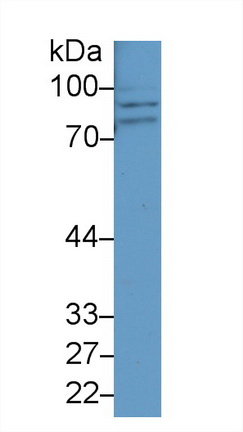 Polyclonal Antibody to Carnitine Palmitoyltransferase 1A, Liver (CPT1A)