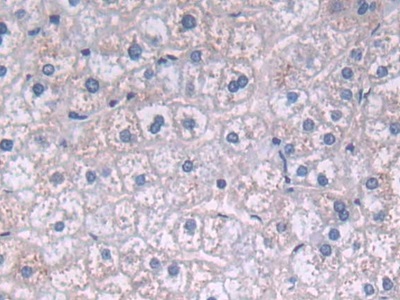 Polyclonal Antibody to Fatty Acid Desaturase 2 (FADS2)