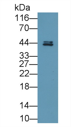 Polyclonal Antibody to Fatty Acid Desaturase 2 (FADS2)