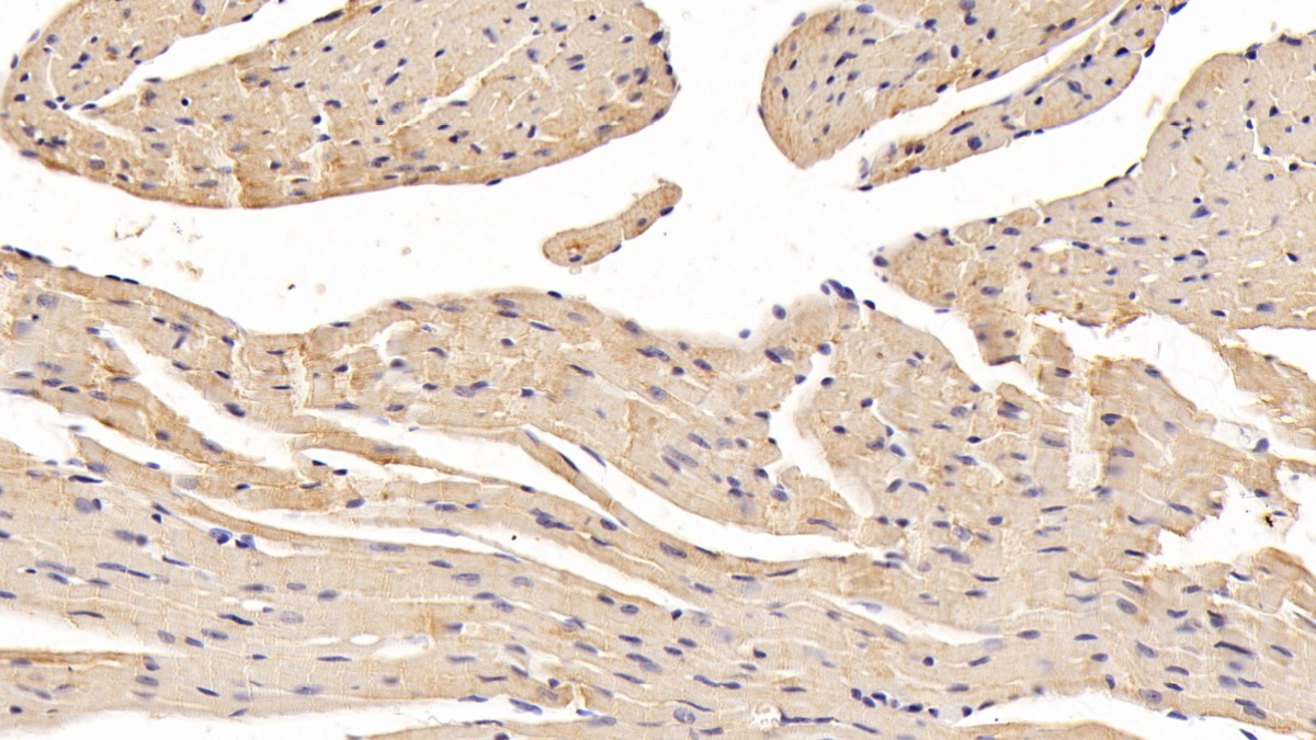 Polyclonal Antibody to Fatty Acid Desaturase 2 (FADS2)