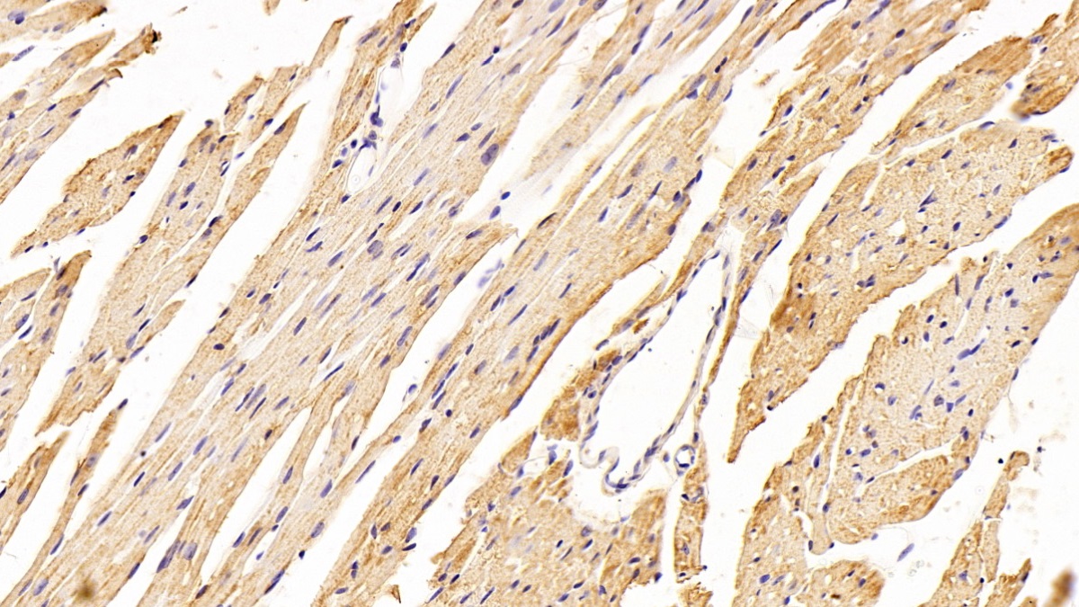 Polyclonal Antibody to Fatty Acid Desaturase 2 (FADS2)