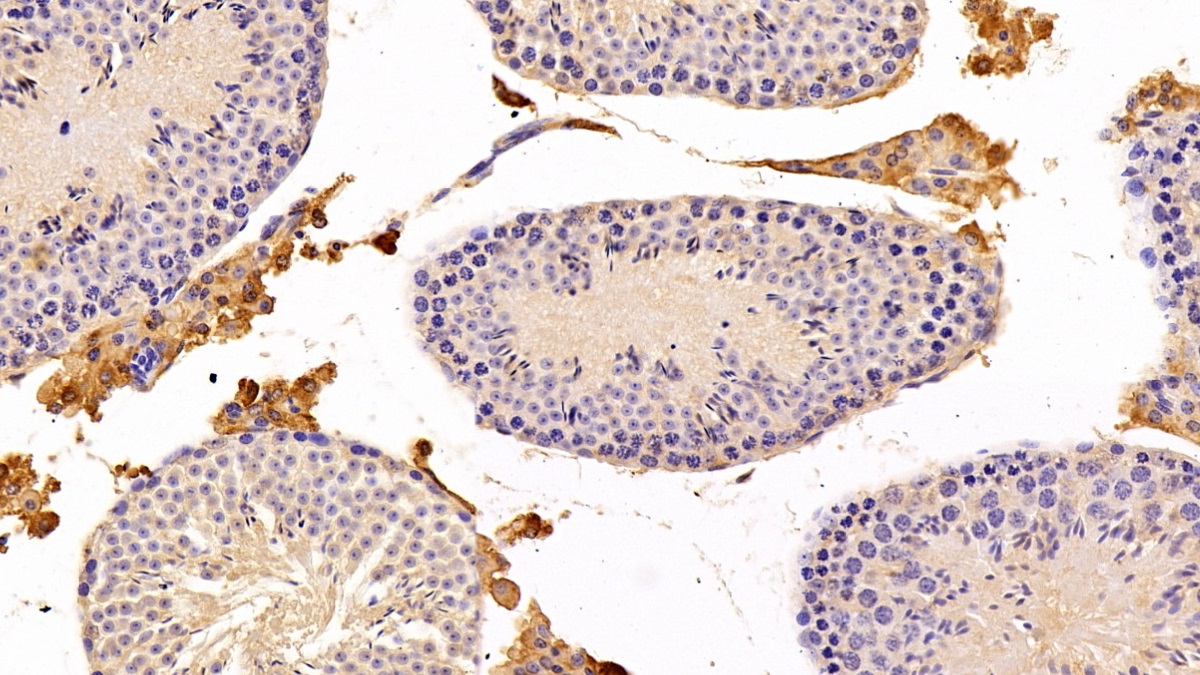 Polyclonal Antibody to Fatty Acid Desaturase 2 (FADS2)