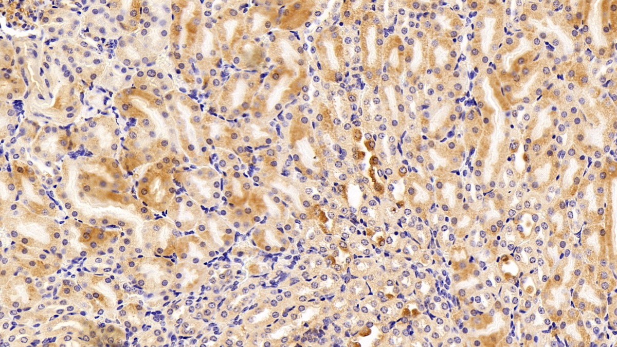 Polyclonal Antibody to Fatty Acid Desaturase 2 (FADS2)