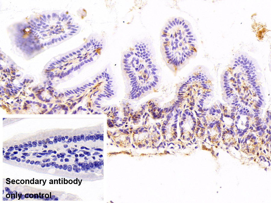 Polyclonal Antibody to G-Elongation Factor, Mitochondrial 2 (GFM2)