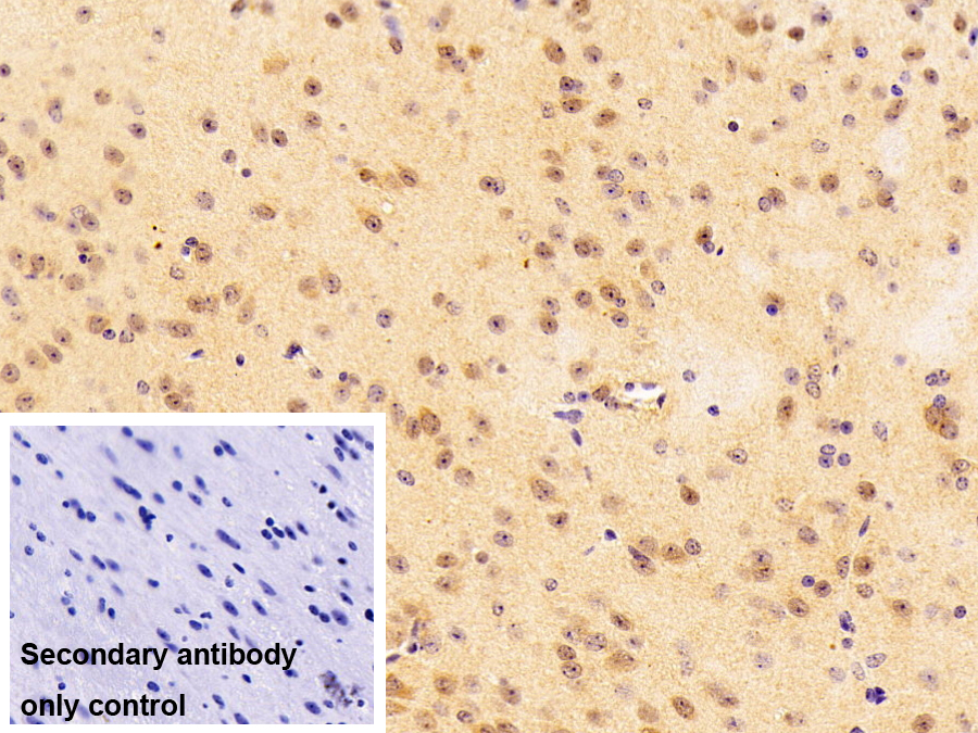 Polyclonal Antibody to G-Elongation Factor, Mitochondrial 2 (GFM2)