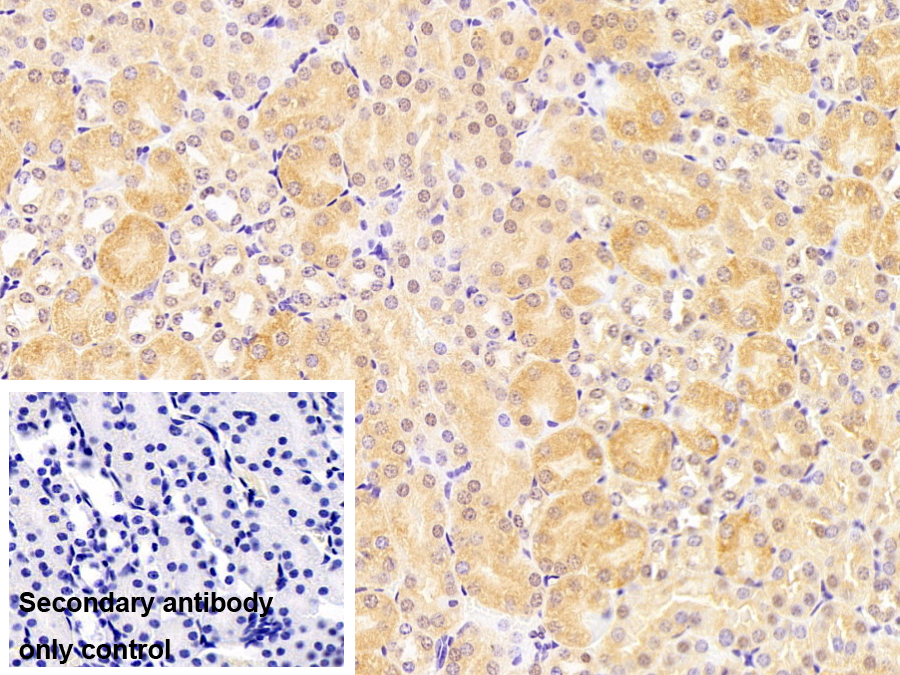 Polyclonal Antibody to G-Elongation Factor, Mitochondrial 2 (GFM2)