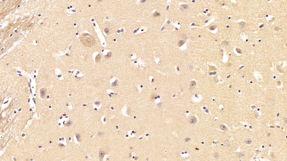 Polyclonal Antibody to Growth Factor Receptor Bound Protein 10 (Grb10)