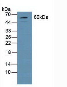 Polyclonal Antibody to Growth Factor Receptor Bound Protein 7 (Grb7)