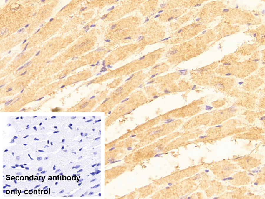 Polyclonal Antibody to Calsequestrin 2 (CASQ2)