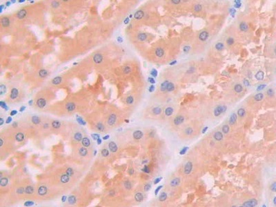 Polyclonal Antibody to Janus Kinase 2 (JAK2)