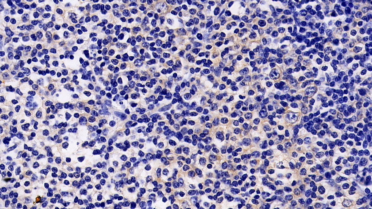 Polyclonal Antibody to Janus Kinase 2 (JAK2)