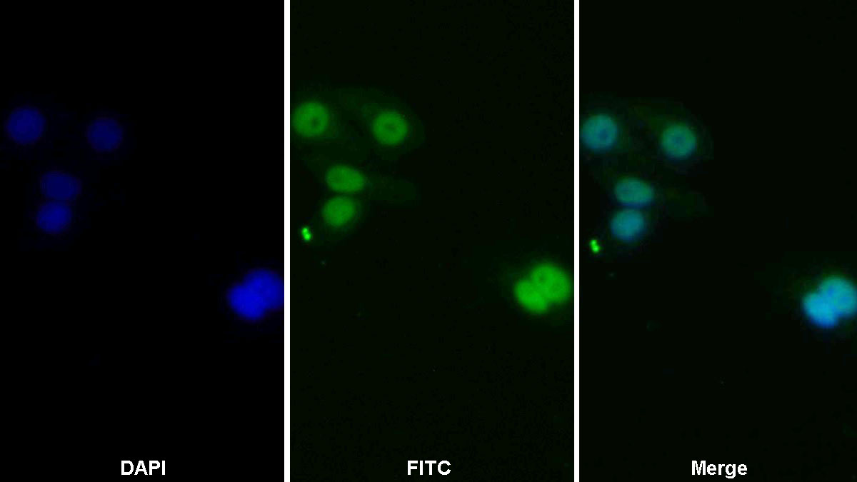 Polyclonal Antibody to Janus Kinase 2 (JAK2)