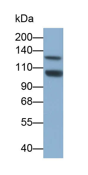 Polyclonal Antibody to Janus Kinase 2 (JAK2)