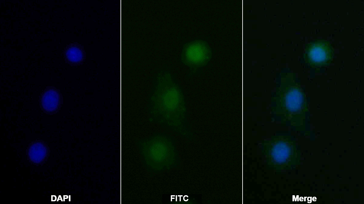 Polyclonal Antibody to Janus Kinase 2 (JAK2)