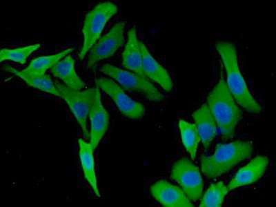 Polyclonal Antibody to Kinesin Family, Member 5A (KIF5A)