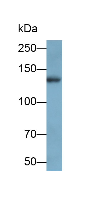 Polyclonal Antibody to Kinesin Family, Member 5A (KIF5A)