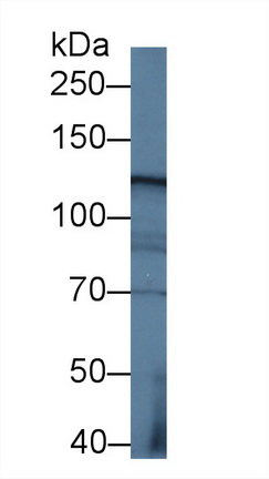 Polyclonal Antibody to Kinesin Family, Member 5A (KIF5A)