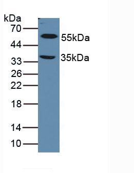 Polyclonal Antibody to Lysyl Oxidase Like Protein 1 (LOXL1)