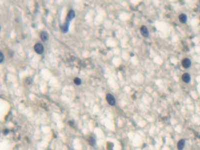 Polyclonal Antibody to Uncoupling Protein 1, Mitochondrial (UCP1)