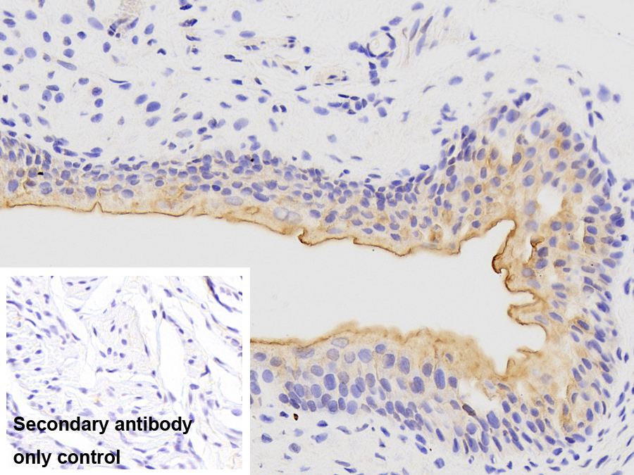 Polyclonal Antibody to Uroplakin 3B (UPK3B)