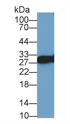 Polyclonal Antibody to Vesicle Associated Membrane Protein Associated Protein A (VAPA)