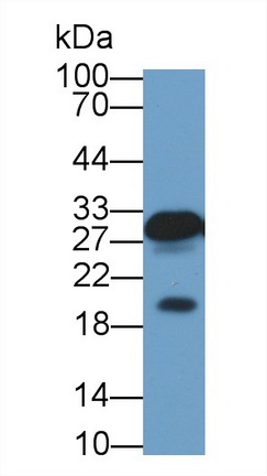 Polyclonal Antibody to Vesicle Associated Membrane Protein Associated Protein A (VAPA)
