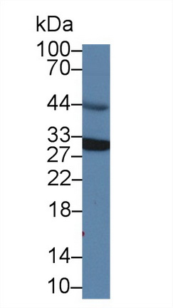 Polyclonal Antibody to Vesicle Associated Membrane Protein Associated Protein A (VAPA)