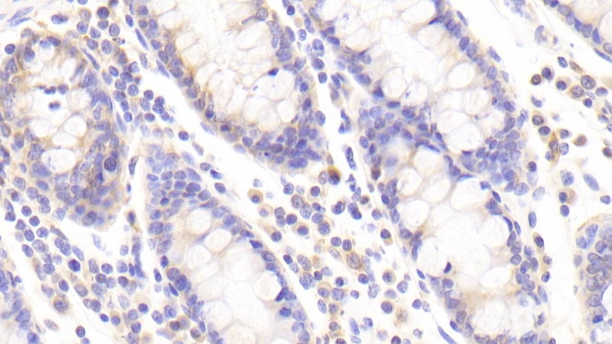 Polyclonal Antibody to Vesicle Associated Membrane Protein Associated Protein A (VAPA)