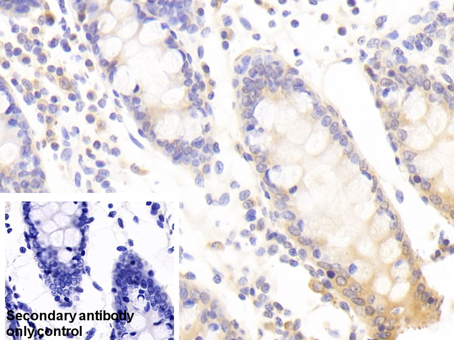 Polyclonal Antibody to Vesicle Associated Membrane Protein Associated Protein A (VAPA)