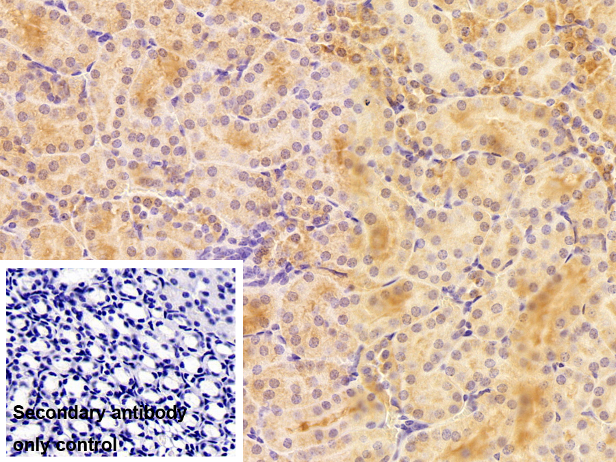 Polyclonal Antibody to Mitofusin 2 (MFN2)