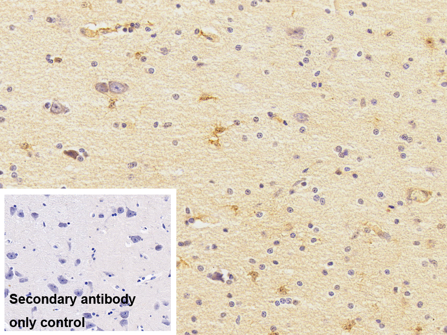 Polyclonal Antibody to Phosphodiesterase 4D, cAMP Specific (PDE4D)