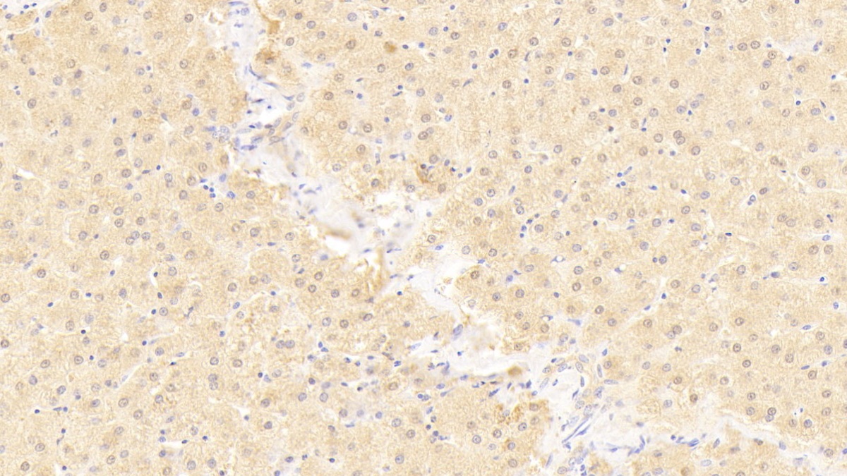 Polyclonal Antibody to Phosphoglucomutase 5 (PGM5)