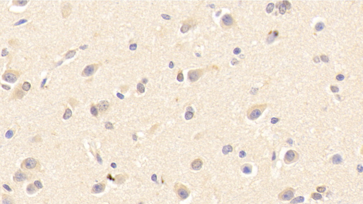 Polyclonal Antibody to Peroxiredoxin 4 (PRDX4)