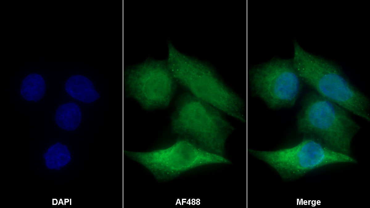 Polyclonal Antibody to Peroxiredoxin 5 (PRDX5)