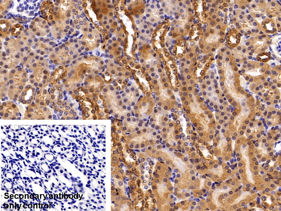 Polyclonal Antibody to Peroxiredoxin 5 (PRDX5)