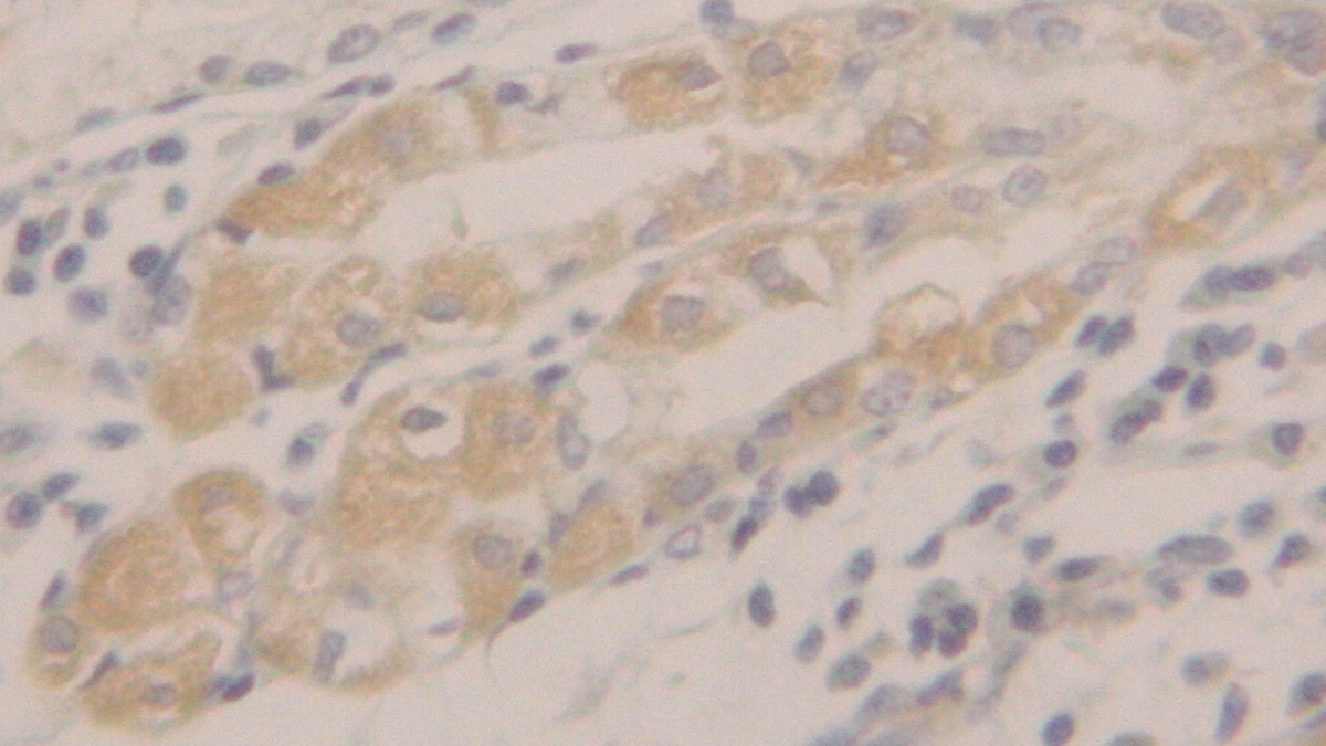 Polyclonal Antibody to Peroxiredoxin 2 (PRDX2)